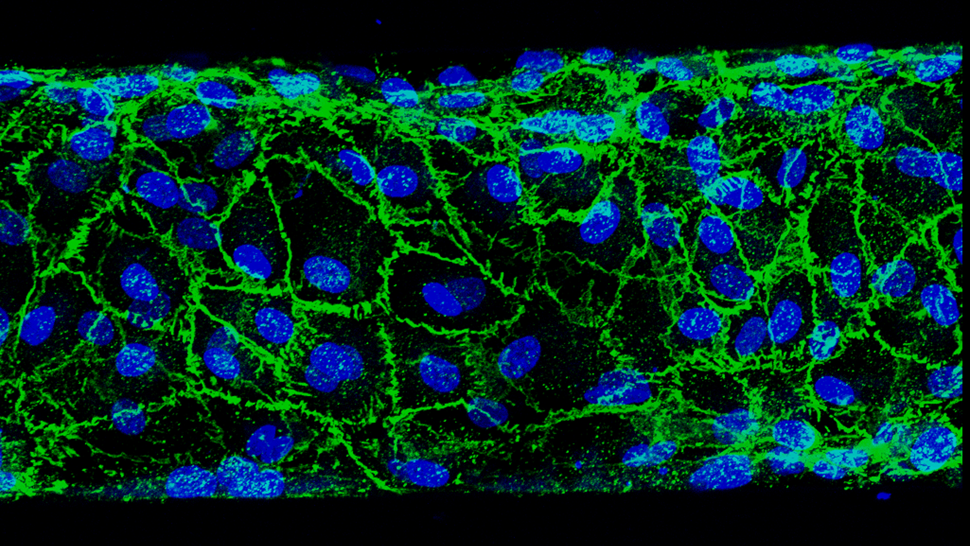 耆那教血管疾病成像